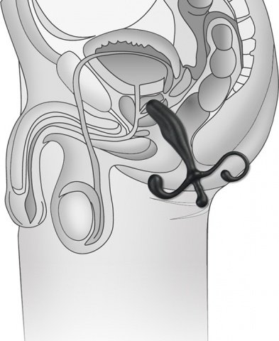   Prostate Gear,  2,   Prostate Gear